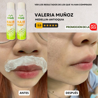 Depilador Instantáneo en Espuma MILADY®  + GRATIS REGALO MISTERIOSO [🔥HOT SALE🔥]